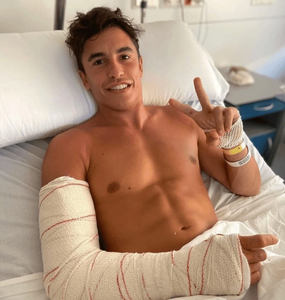 Il terribile infortunio di Marc Marquez: il 2 giugno 2022 lo spagnolo venne operato per la quarta volta
