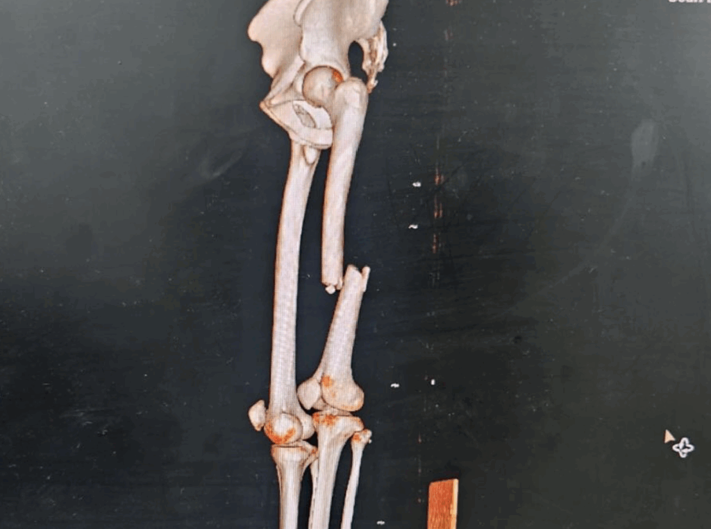 Infortunio David Munoz: ecco le condizioni del pilota e il sostituto per Phillip Island