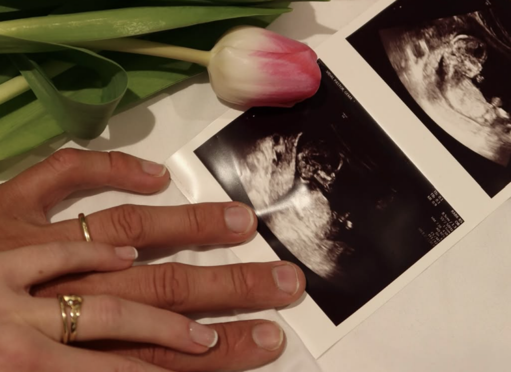 Iker Lecuona diventerà papà: ecco l'annuncio sui social